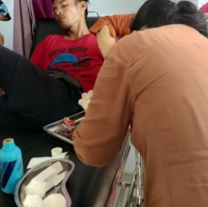 Polemik DAS Senabah PT Agricinal, Dua Warga Diduga Kena ‘Dor’ Peluru Karet